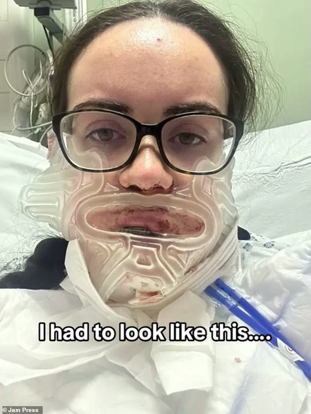 Luisa McDermott's 10-Year Jaw Surgery Battle: Emotional TikTok Series Exposes Struggles and Triumphs