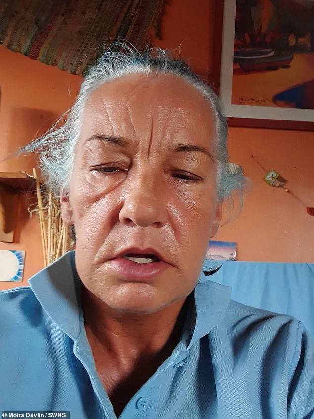 A Mother's Disfigurement: The Alarming Risks of Costly Dental Implants to Communities