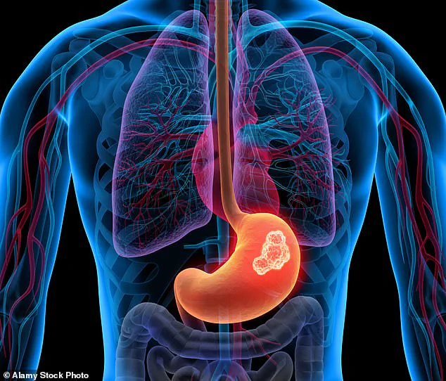 Ignoring Persistent Indigestion Could Signal Serious Health Risks, Warns Expert