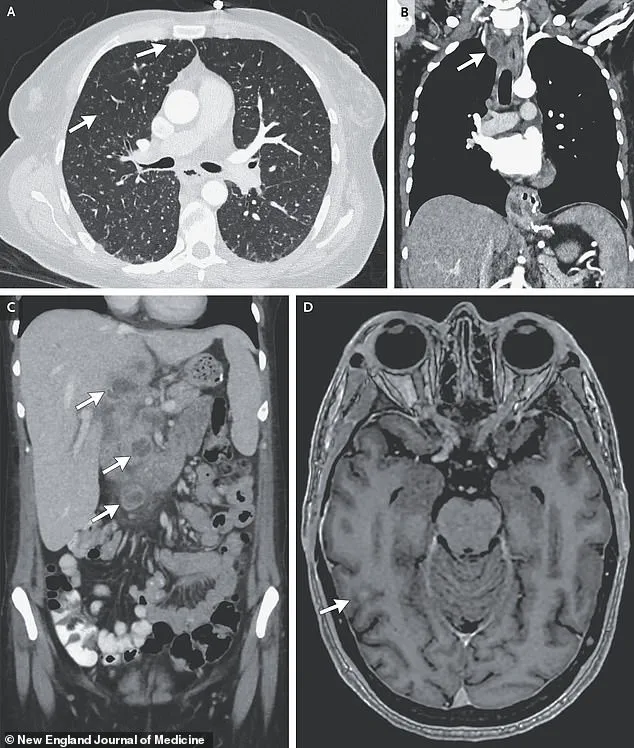 Mental Health and Infection Control: Expert Advisories on Integrated Public Health Strategies