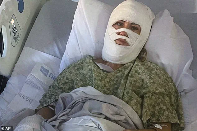 Restricted Access: The Untold Story of Ashley Wasielewski's Acid Attack and Its Hidden Consequences
