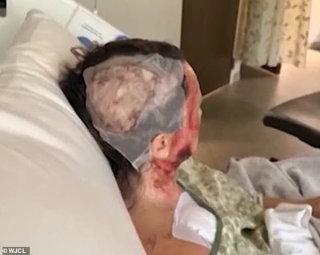 Restricted Access: The Untold Story of Ashley Wasielewski's Acid Attack and Its Hidden Consequences