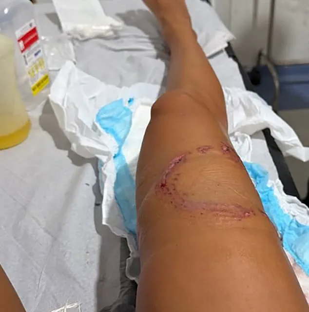 Shark Attack in Brazil's Fernando de Noronha Archipelago Sparks Debate Over Tourism Regulations and Safety Measures