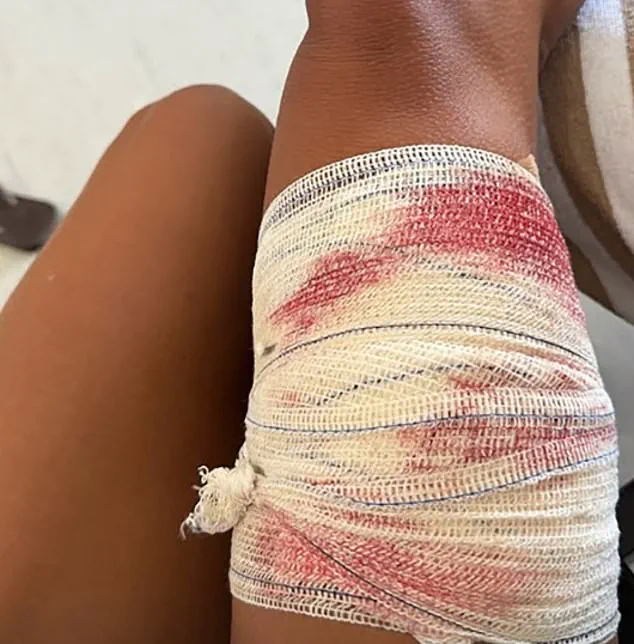 Shark Attack in Brazil's Fernando de Noronha Archipelago Sparks Debate Over Tourism Regulations and Safety Measures