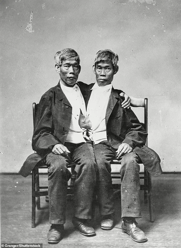 Blurring Reality: AI Influencers and the Hidden Struggles of Conjoined Twins