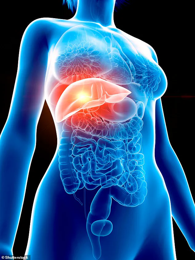Misdiagnosed Menopause Symptoms Lead to Liver Fibrosis Discovery in Mother of Four