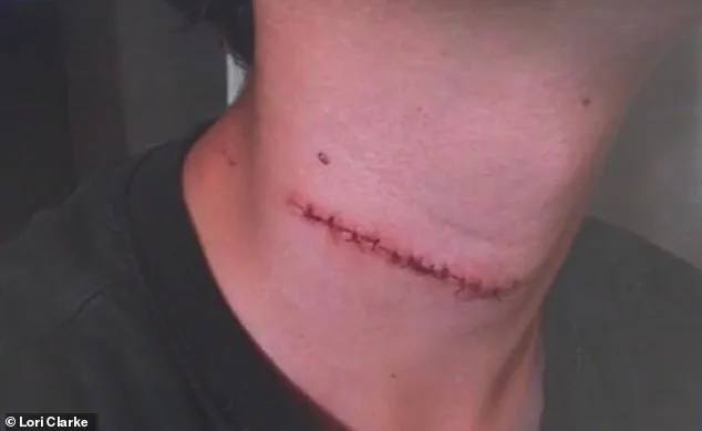 Teen Slashed in Random Attack on Daytona Beach Boardwalk: Mother Speaks Out