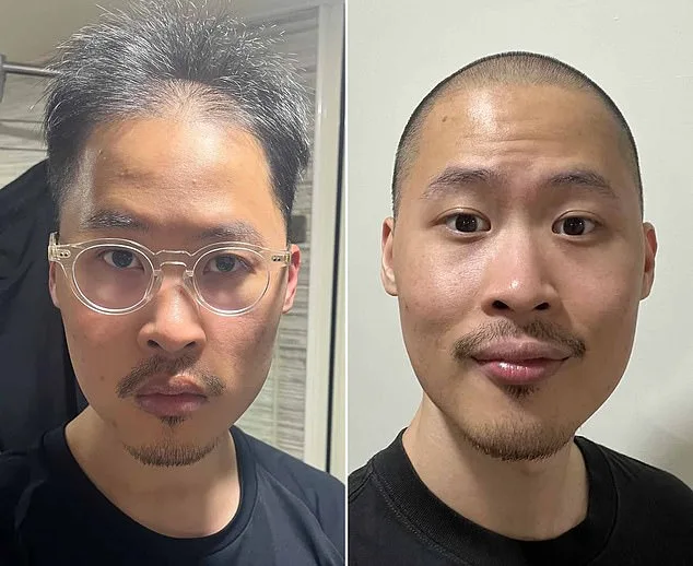 r/bald: A Digital Oasis of Encouragement and Positivity in the Fight Against Baldness