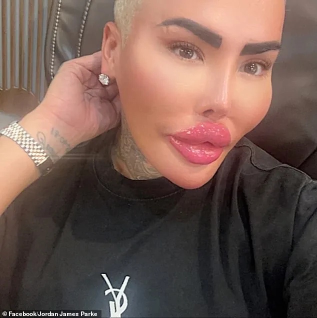The Lip King's Sudden Death Leads to Manslaughter Charges and Calls for Beauty Industry Regulation