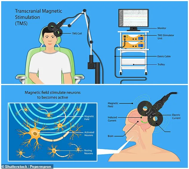 Breakthrough in Depression Treatment: Accelerated TMS Offers Rapid Relief in Just Five Days