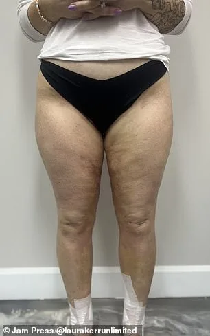 From Misdiagnosis to Revelation: The Hidden Battle Behind Laura Kerr's Unexplained Weight Gain