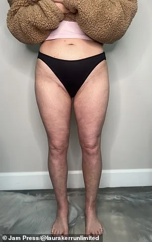 From Misdiagnosis to Revelation: The Hidden Battle Behind Laura Kerr's Unexplained Weight Gain
