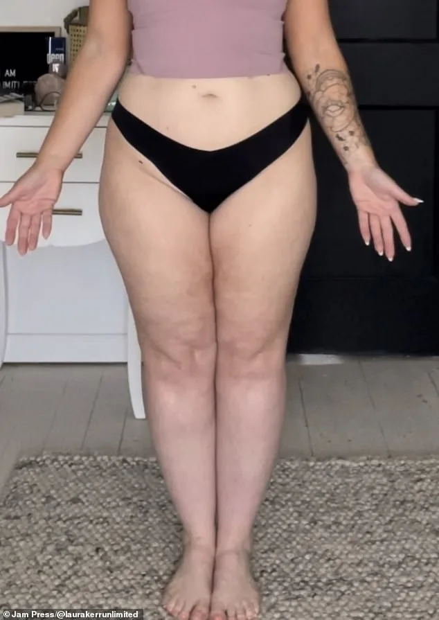 From Misdiagnosis to Revelation: The Hidden Battle Behind Laura Kerr's Unexplained Weight Gain