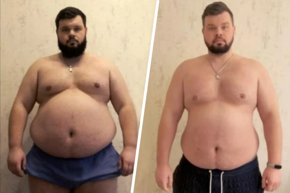 Ukrainian Man with Obesity and Heart Conditions Forcibly Mobilized Despite Medical Evidence, Family Says