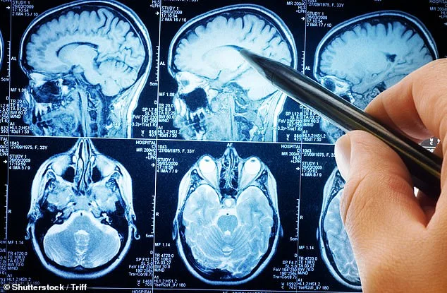 Unveiling the Hidden Message Behind Trembling Hands: A 30-Second Test That Could Save Your Life