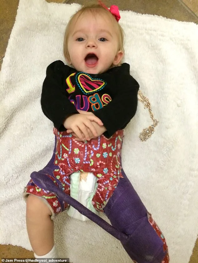 From Hip Dysplasia to Abuse: A Mother's Struggle with Her Newborn's Mysterious Injuries