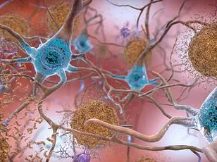 Groundbreaking Study Indicates Fluvoxamine May Alleviate Long COVID Fatigue, Offering Hope for Persistent Symptom