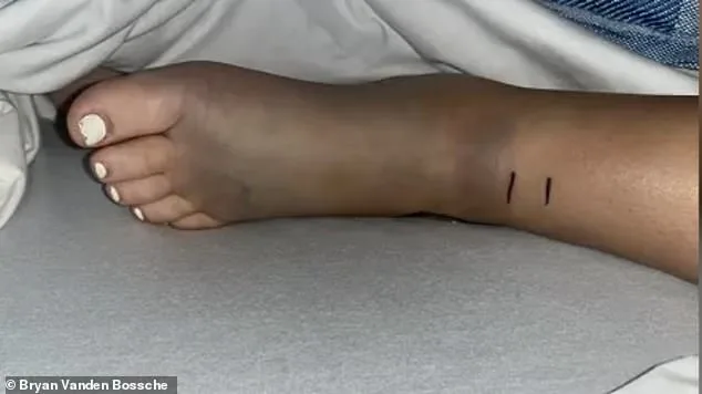 14-Year-Old California Girl Fights for Life After Rattlesnake Bite During Bike Ride