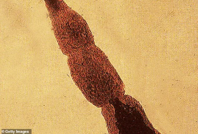 Deadly Tapeworm Spreads to Pacific Northwest as Study Reveals Growing Public Health Threat