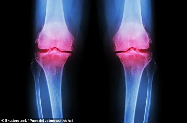 Revolutionary Lab-Grown Knee Treatment Offers Permanent Solution for 32 Million Americans with Osteoarthritis