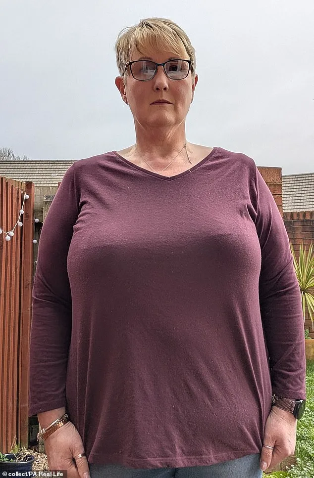 Joanna Brice's severe macromastia causes debilitating pain and lifelong bullying.