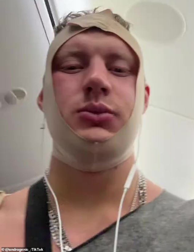 Jetstar Removes Influencer for Flying While Drowsy After Recent Surgeries