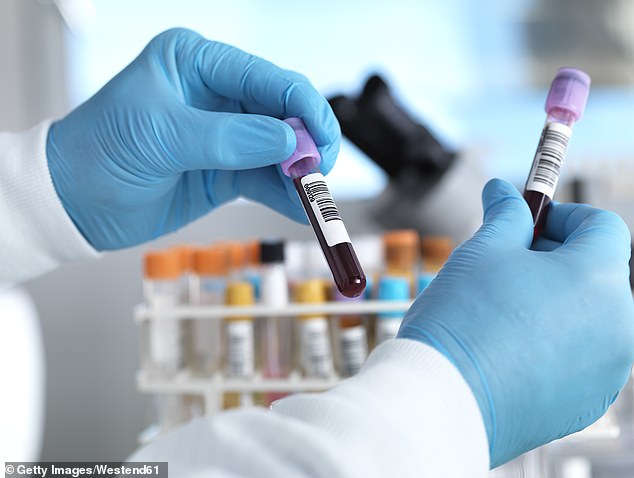 NHS-backed blood test could save 30,000 lives by detecting cancer early.